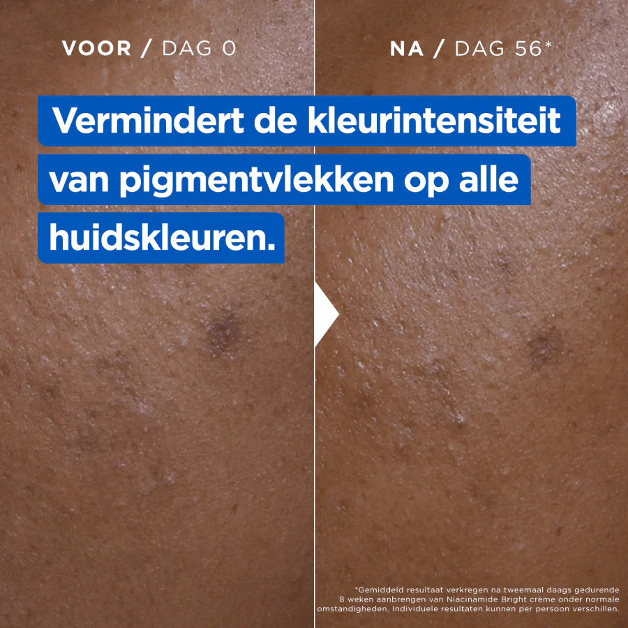 Productafbeelding 5