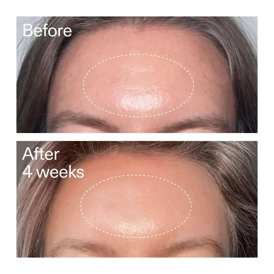 Productafbeelding 3